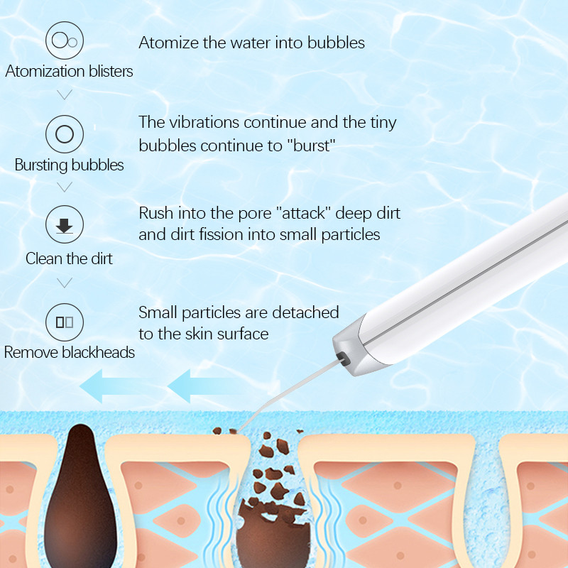Professzionális arc pórustisztító bőrradír Sonic Face Ionic Peeling Beauty Machine Ultrahangos bőr spatula