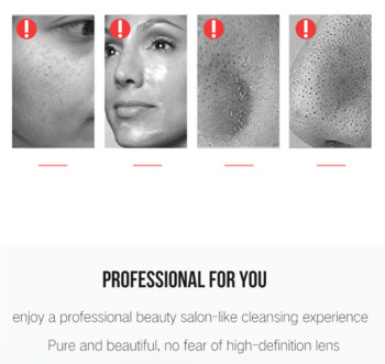 Ultrasonic Facial Skin Scrubber Cleaner Ion Acne Remover Blackhead Peeling Shovel Cleaner Facial Massager Περιποίηση δέρματος