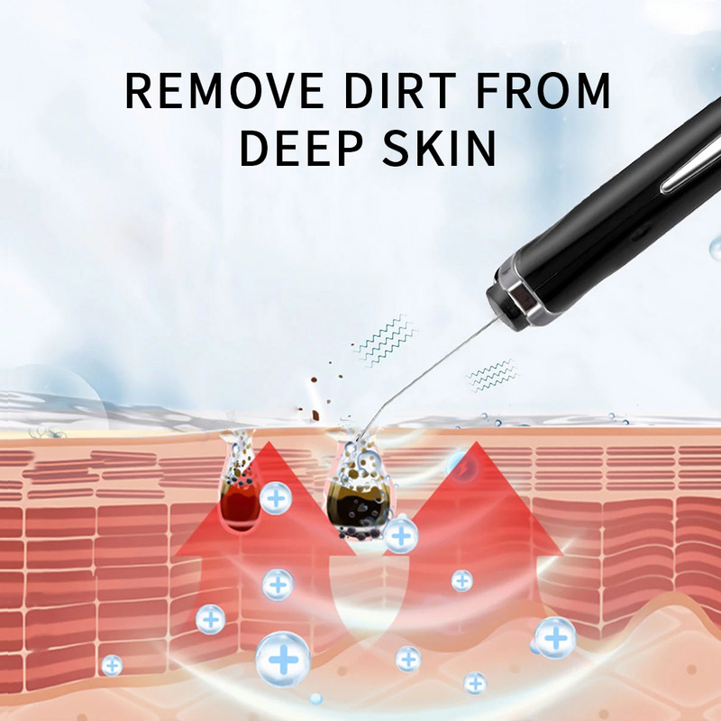Arctisztító lapát Ultrahangos Bőrradír Vibrációs Arc Spatula Mitesszer eltávolító Tiszta Scraper Kavitációs Peeling
