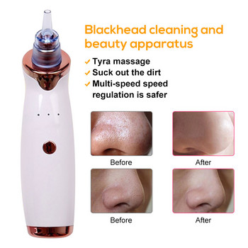 Ultrasonic Scrubber Face Scraper Remover Facial Cleansing Kit Απολέπιση προσώπου Deep Facial Cavitation Συσκευή απολέπισης