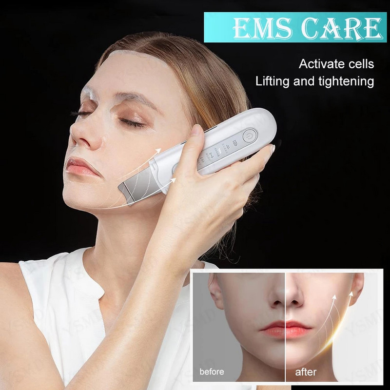 Ultrahangos arcbőrradír tisztító akne mitesszer eltávolító EMS peeling lapát Arctisztító Bőrápoló Lift Szépségeszközök