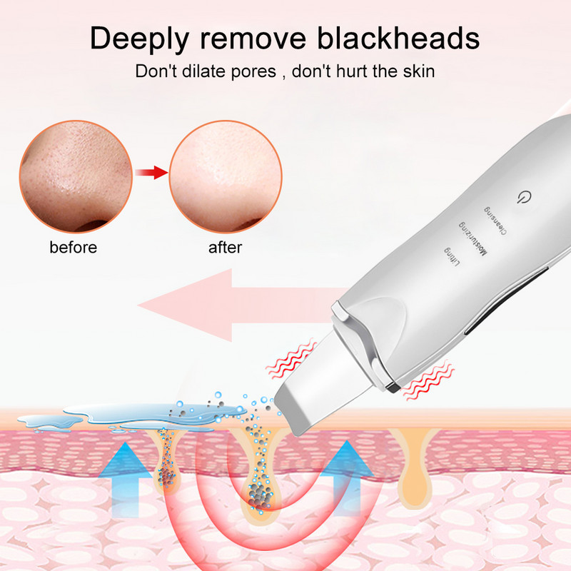 Ultrahangos bőrradír mélytisztító mitesszer eltávolító arcradír Vibráló bőr spatula peeling szépségápolási eszköz