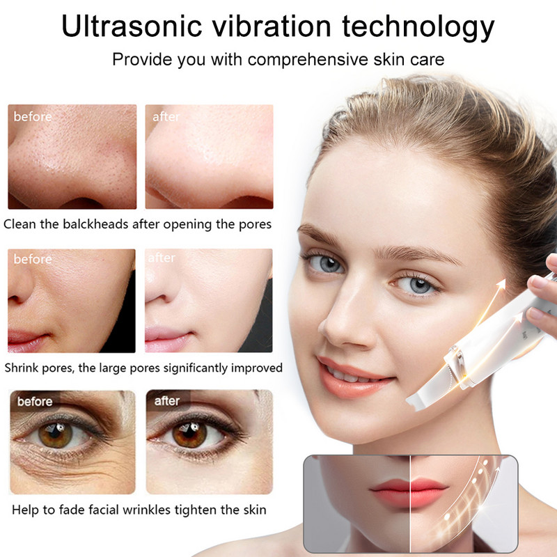 Ultrahangos bőrradír mélytisztító mitesszer eltávolító arcradír Vibráló bőr spatula peeling szépségápolási eszköz