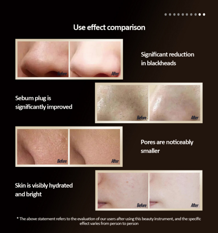 Ultrahangos arctisztító bőrradír Ultrahangos vibrációs masszírozó Ultrahangos peeling Clean Tone Lift súroló