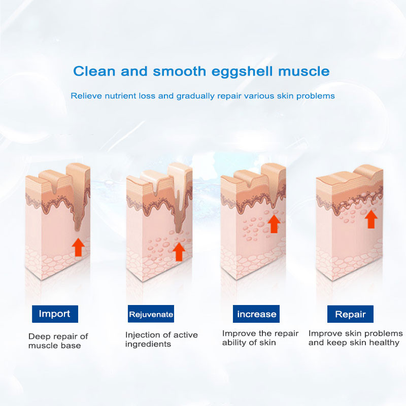 Arctisztító ultrahangos bőrradír mélytisztító ion akne mellett mitesszerek és akne peeling szépségápolási eszközök