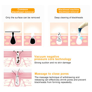 Υπερηχητικό Skin Scrubber Vacuum Remover Blackhead Spatula Face Shovel Clean Cavitation Peeling Facial Lifting Devices