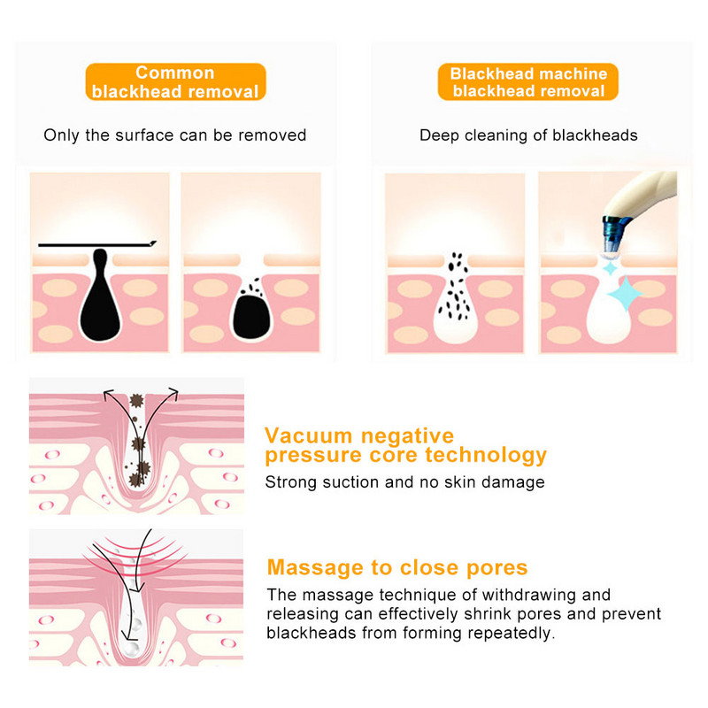 Ultrahangos bőrradír vákuum mitesszer eltávolító vibrációs arc spatula lapát Tiszta kavitációs peeling arc lifting eszközök
