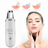 Skin Scrubber Facial Skin Scrubber Electric SPA Gyengéd mitesszer eltávolító Ultrahangos arctisztító spatula arc lifting masszírozó