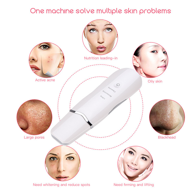 Újratölthető ultrahangos arcbőrradír arctisztító peeling vibrációs mitesszer eltávolító hámlasztó pórustisztító eszközök