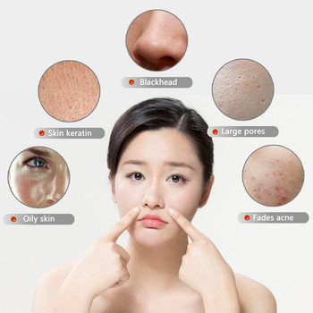 Ultrasonic Cleaner Deep Cleaning Face Deep Cleaning Remover Blackhead Skin Scrubber Ultrasonic Skin Skin Skin Lifting Μείωση των κηλίδων των ρυτίδων