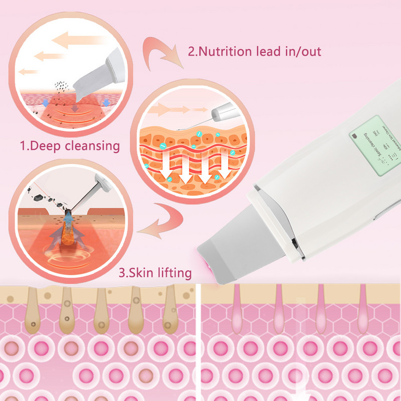 Ultragarsinis veido valiklis giliai valantis inkštirų valiklis Ultragarsinis odos šveitiklis Odą balinantis kėlimas mažina raukšles ir dėmes