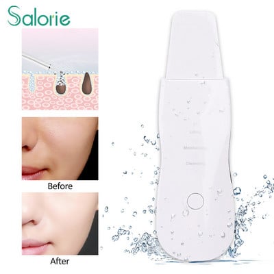 Ultrahangos bőrradír vibrációs arctisztító mitesszer eltávolító arcradír lapát Tiszta kavitációs peeling arc lifting