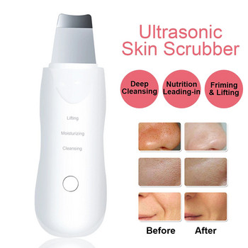 Ultrasonic Skin Scrubber Deep Face Cleaning Machine Cleaning Pore Cleaning Skin Rejuvenation Beauty Instrument Lift Beauty Instrument