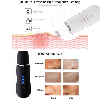 Ultrasonic Scrubber Deep Cleansing Face Scrubber Facial Cleansing Shovel Απολέπιση Skin Scraper Peeling Beauty Instrument