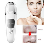Ultrahangos arcbőrradír nagyfrekvenciás vibrációs arc spatula tisztítás pórusos szennyeződés eltávolítása mitesszer peeling lifting eszköz