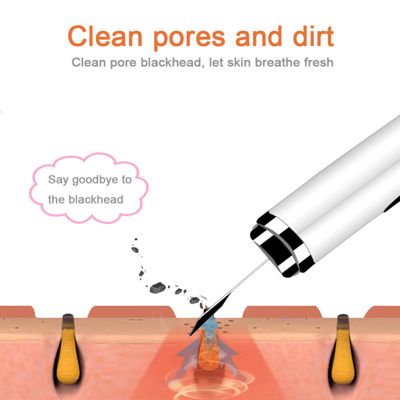Ultrahangos arcbőrradír nagyfrekvenciás vibrációs arc spatula tisztítás pórusos szennyeződés eltávolítása mitesszer peeling lifting eszköz