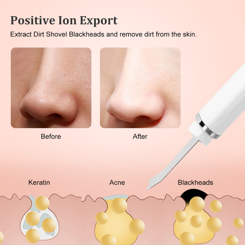 Vibrációs arc spatula ultrahangos bőrradír mitesszer eltávolító arcradír lapát Tiszta kavitációs peeling arc lifting