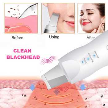 Νέο Ultrasonic Skin Scrubber Vibration Spatula Face Remover Shovel Clean Cavitation Peeling Facial Lifting Περιποίηση δέρματος