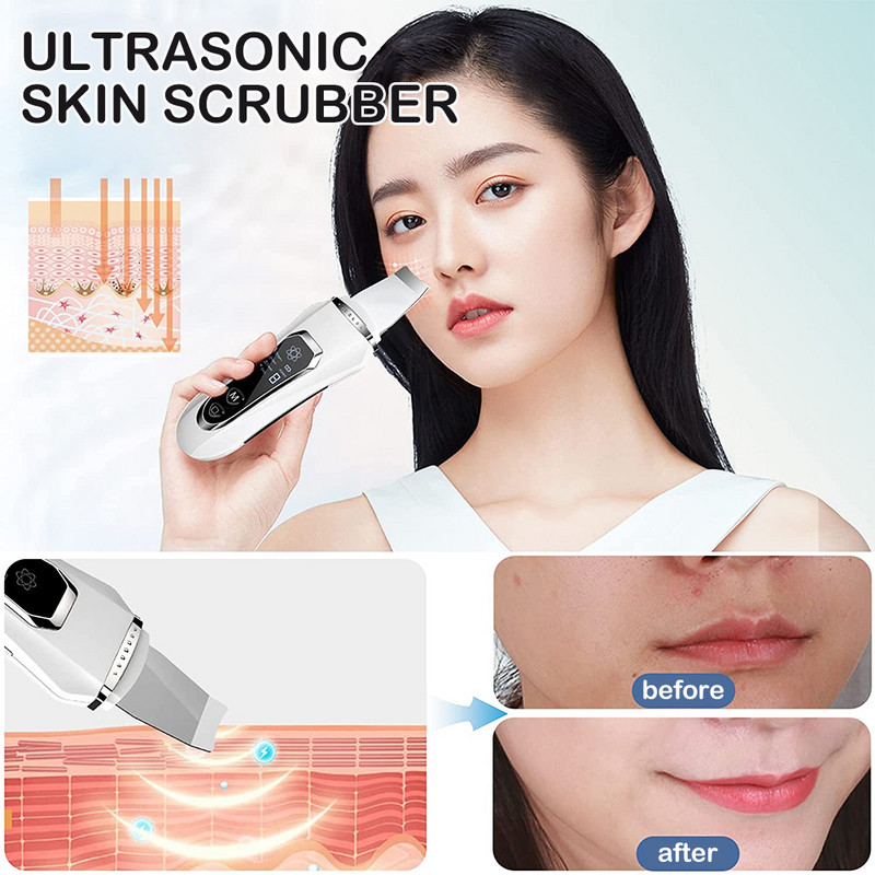 Arc ultrahangos tisztító mitesszer eltávolító akne pórusos arctisztító EMS Face Lift peeling lapát Ion ultrahangos bőrradír