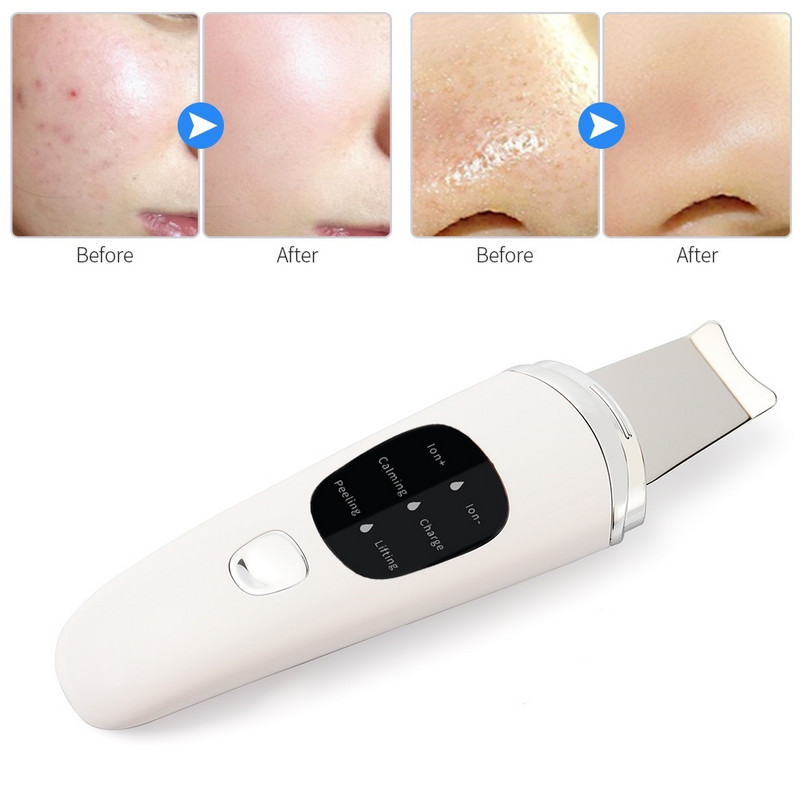 Professzionális ultrahangos arcbőrradír mély arctisztító gép peeling lapát arc pórustisztító arc lifting gép