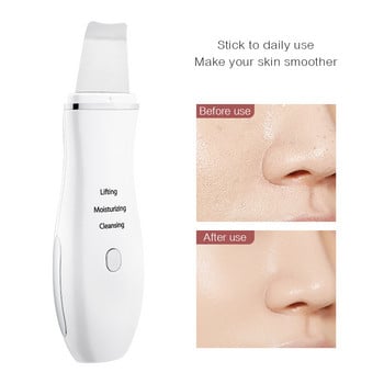 Skin Scrubber Ultrasonic Skin Scrubber Spatula Face Remover Facial Scrubber Shovel Clean Cavitation Peeling Machine 45G