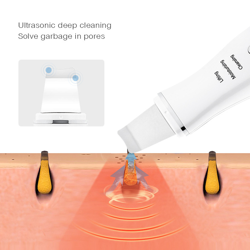 Ultrahangos bőrradír vibrációs arc spatula mitesszer eltávolító arcradír lapát Clean kavitációs peeling gép 45G