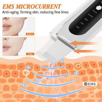 Ултразвуков скрубер за кожа EMS Микротокова машина за лифтинг на лице LED червена и синя светлина Премахване на черни точки Устройство за дълбоко почистване на лице