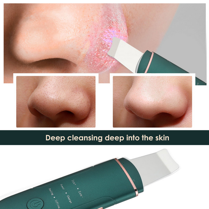 EMS ultrahangos bőrradír mély arctisztító gép vibrációs peeling lapát arc pórustisztító arc lifting szépségápolási eszközök
