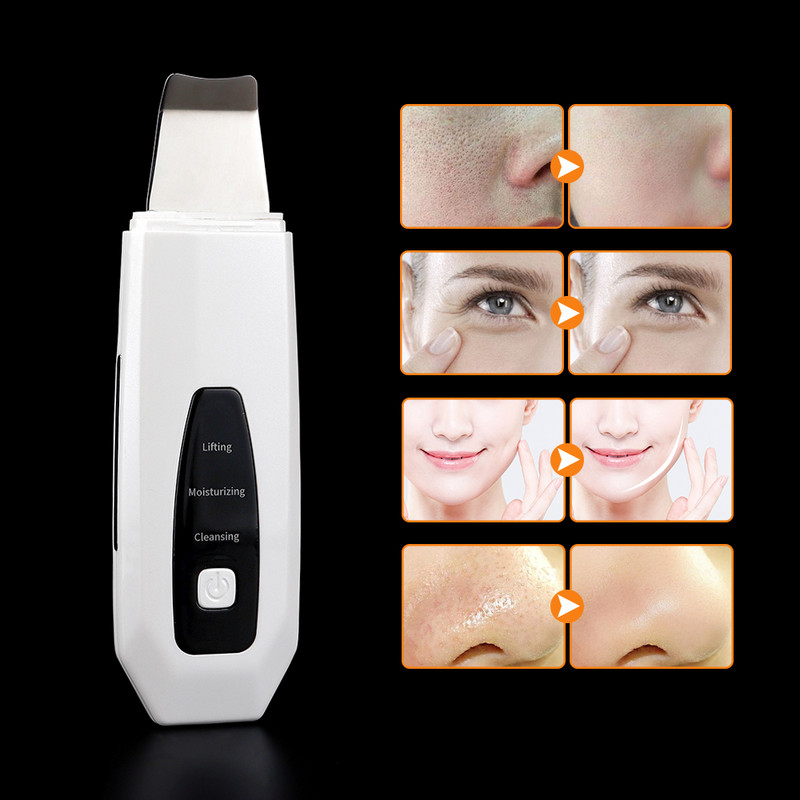Ultrahangos bőrradír peeling mitesszer eltávolítása mély arctisztító gép arc lifting öregedésgátló arctisztító masszírozó