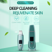 Ultrahangos bőrradír vibrációs arc professzionális spatula mitesszer eltávolító lapát tisztító kavitációs peeling arc lifting