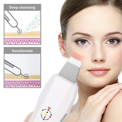 Recharge Ultrahangos súroló masszírozógép bőr mélytisztító készülék Anionos arcbőrápoló peeling lifting súroló