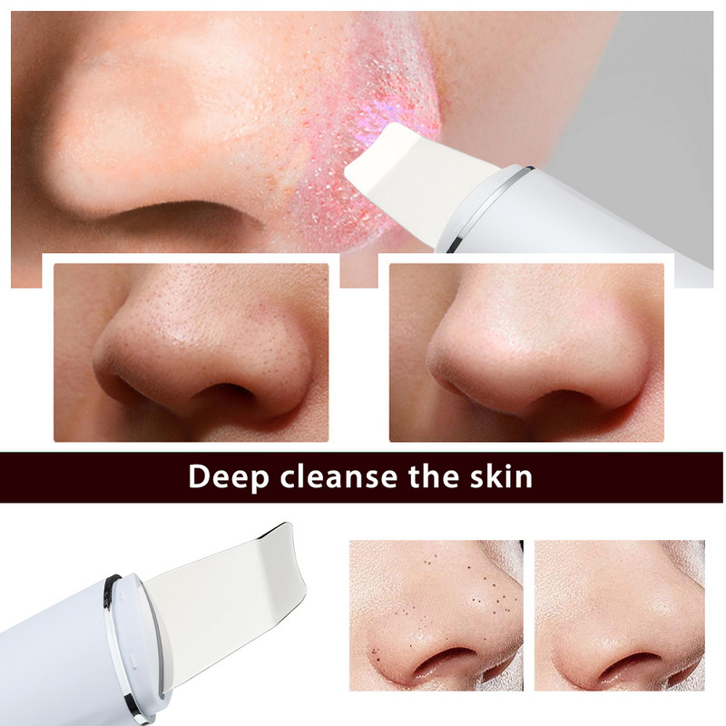 Ultrahangos bőrradír mitesszer eltávolító arctisztító 4 módú peeling lapát arcemelő eszköz EMS spatula mélytisztító