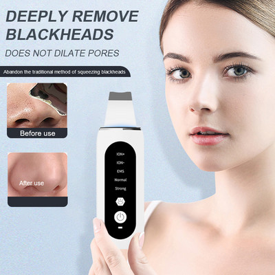 Ultrahangos bőrradír peeling mitesszer eltávolító mély arctisztító ultrahangos ionos ance pórustisztító arclapátos arctisztító