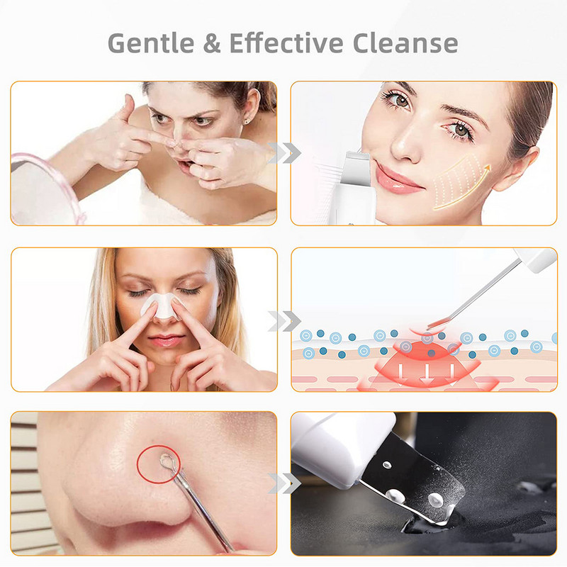Υπερήχων Peeling Shovel Spatula Scrubber Ion Deep Facial Clean Removal Pore Cleaner Face Lift Beauty Machine