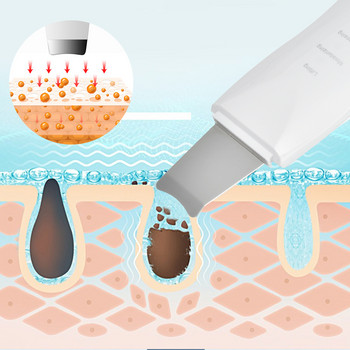 Υπερηχητικό Skin Scrubber Vibration Facial Scrubber Φτυάρι αφαίρεσης μαύρων στιγμάτων ιοντικό Deep Clean Peeling Facial Lifting Συσκευές ομορφιάς