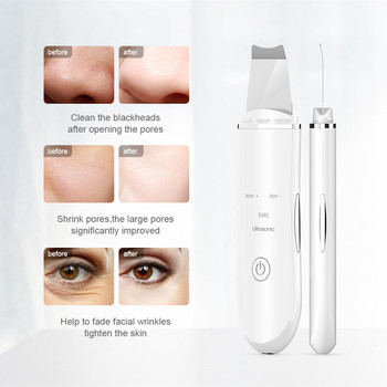 Face Cleaner Ultrasonic Skin Scrubber Deep Cleaning Peeling Shovel Facial Pore Lift Machine Ultrasonico Facial