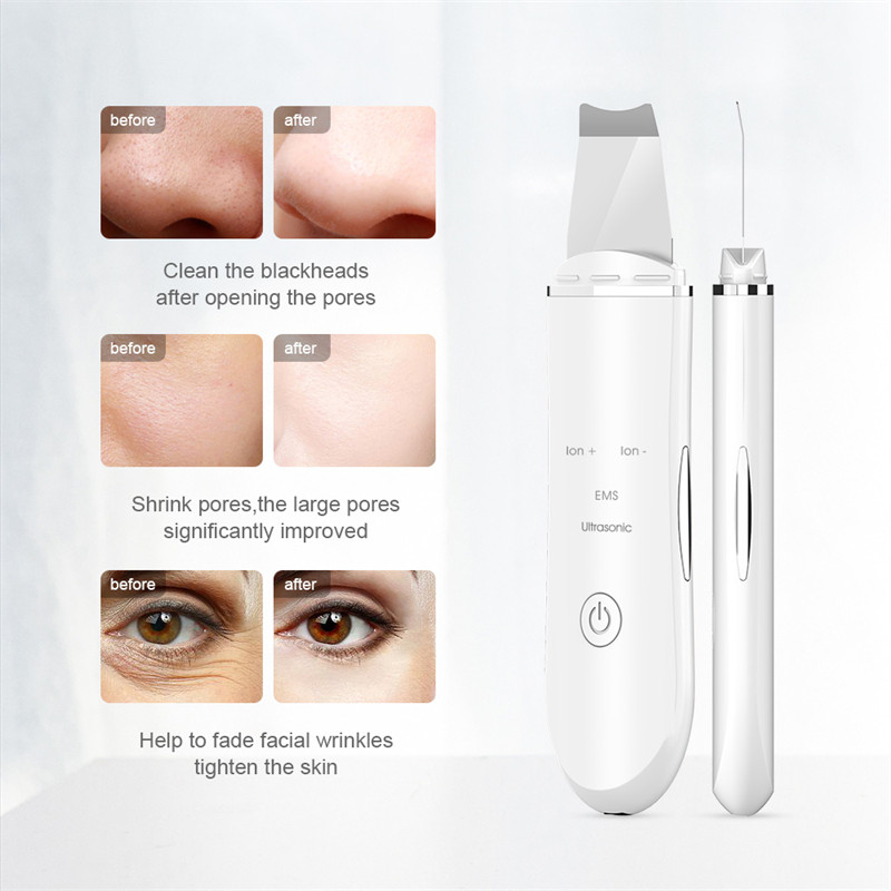 Arctisztító ultrahangos bőrradír Mélytisztító peeling lapát arc pórusemelő gép Ultrasonico arcápoló