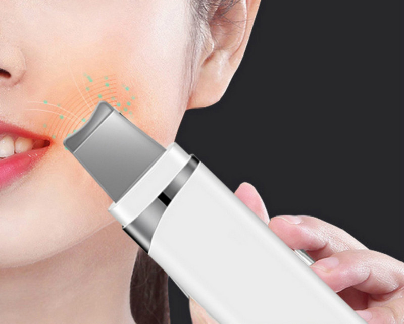 Elitzia ET8023 Beauty Tools Ultrahangos bőrradír mitesszer eltávolító pórustisztító otthoni használatra