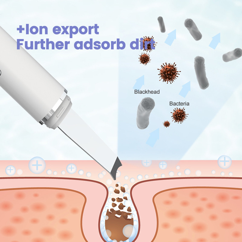 Ultrahangos bőrradír EMS vibrációs arc spatula mitesszer eltávolító lapát Tiszta kavitációs peeling arc lifting bőrápolás