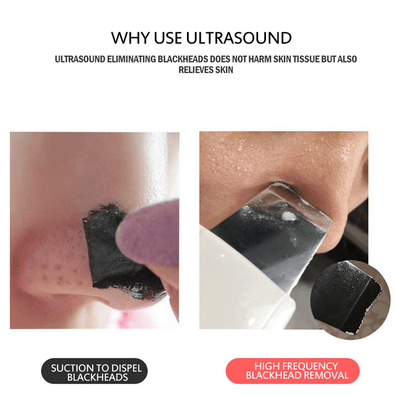 Ultrahangos bőrradír arcvibrátor masszázs arc mélytisztító bőrápoló gép mitesszer ránc pórustisztító szépségápolási eszköz
