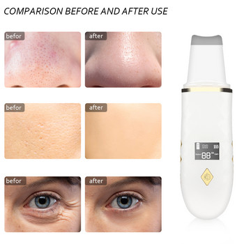 Υπερηχητικό Skin Scrubber Facial Ion Deep Pores Cleaning Acne Require Removal Μαύρο Στίγμα Peeling Extractor Λεύκανση δέρματος