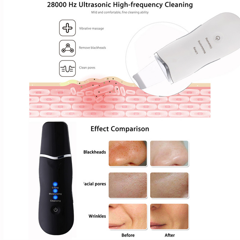Ultrahangos súroló peeling mélytisztítás kavitációs peeling ultrahangos spatula hámlasztó szépség- és bőrápolás