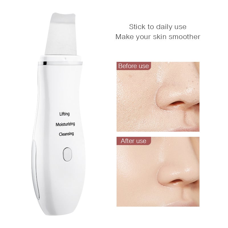 Ultrahangos bőrradír Black Head Deep Remover negatív ionfolt spatula tisztító akne elleni elektromos arctisztító gép F30