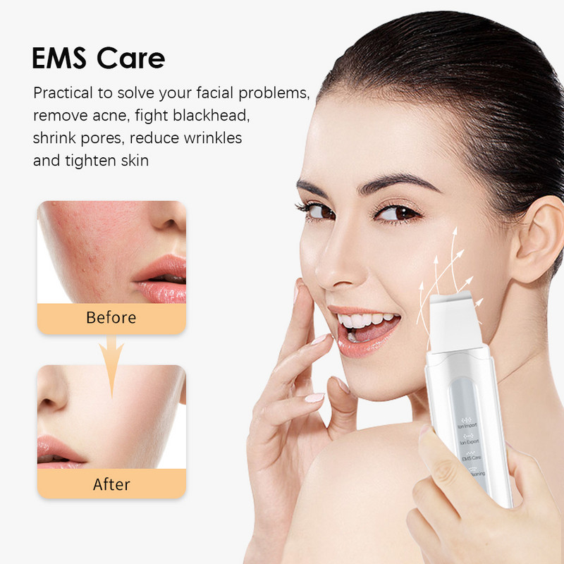 Ultrahangos Bőrradír Vibrációs Arc Spatula Mitesszer eltávolító Lapát Tiszta Kavitációs Peeling Arc Lifting Bőrtisztítás