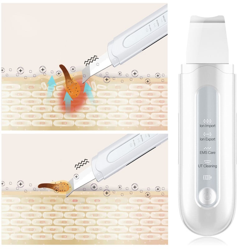 Ultrahangos Bőrradír Vibrációs Arc Spatula Mitesszer eltávolító Lapát Tiszta Kavitációs Peeling Arc Lifting Bőrtisztítás