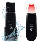 Ultrahangos tisztító 45°C hő Ultrahangos bőrradír Mély arctisztító gép Lapátos Bőrápoló Face Lift Peeling Arckezelés