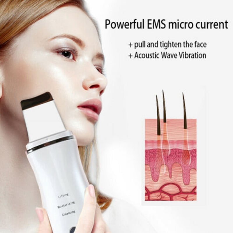 6 az 1-ben ultrahangos bőrradír vibrációs arc spatula mitesszer eltávolító mélytisztító lapátos peeling arc lifting