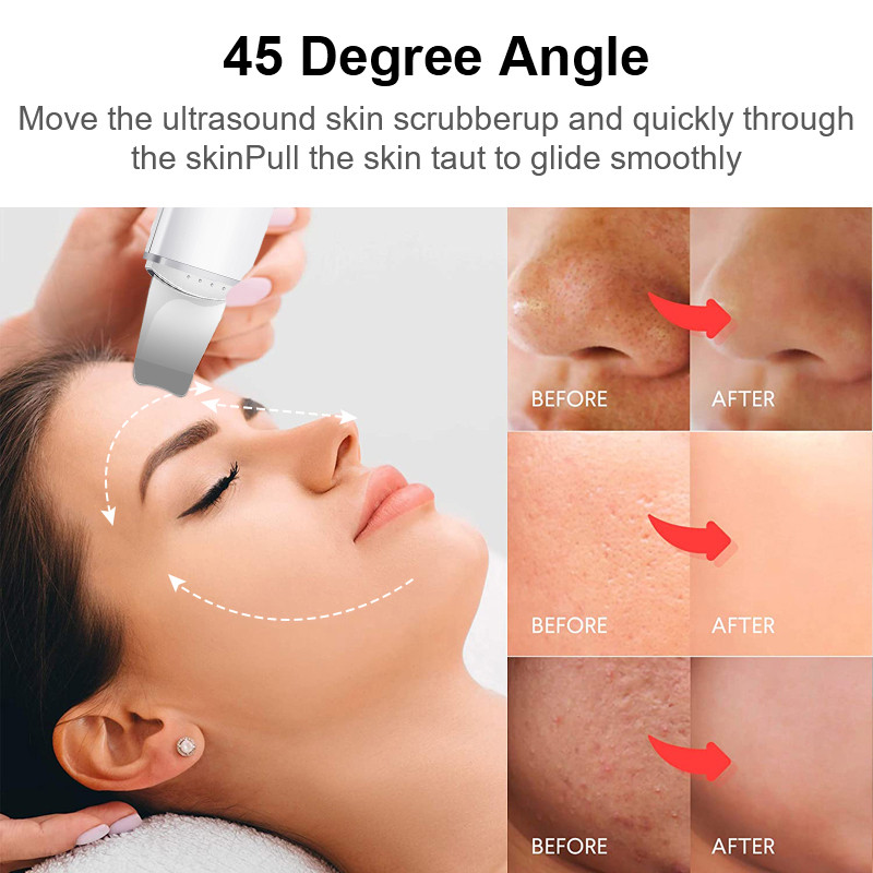 Bőrradír Vibrációs Arc Spatula Mitesszer eltávolító Lapát Tiszta Kavitációs Peeling Arc lifting