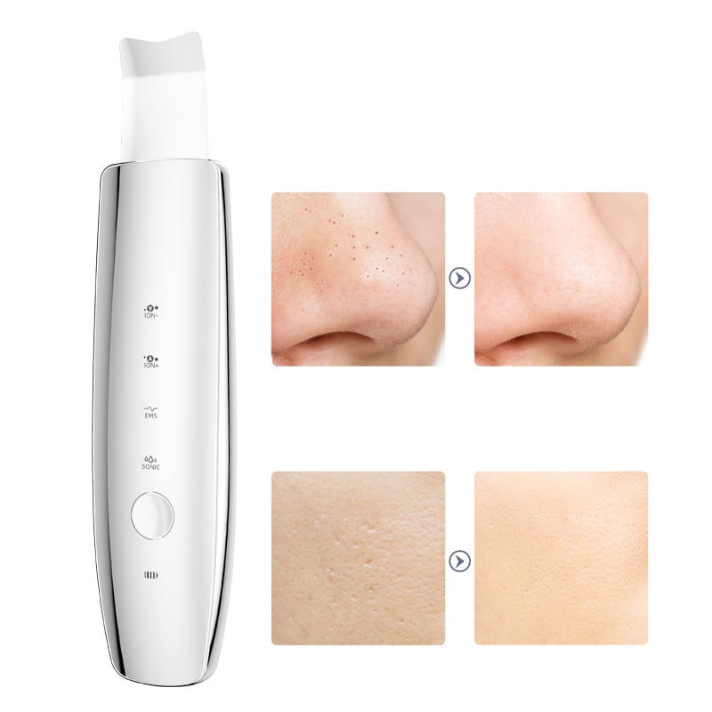 Skin Scrubber Facial Led Ultrahangos Arctisztító Sonic Peeler Bőrradír Kék és Piros Világos Mitesszer kaparó