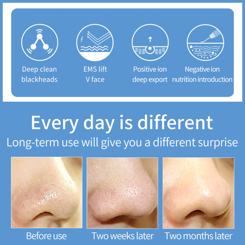 Uofenna Ultrasonic Skin Scrubber Deep Face Cleaning Shovel Ion EMS Peeling Shovel Facial Pore Cleaner Face Skin Lift Beauty